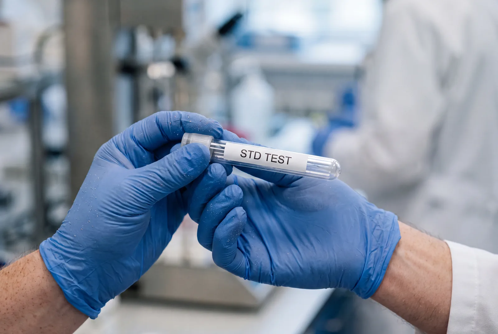 Lab vial at Urgent Care USA, Plant City FL